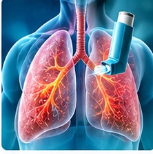 Asthma illustration