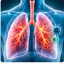 TB, Cough & Respiratory Diseases illustration